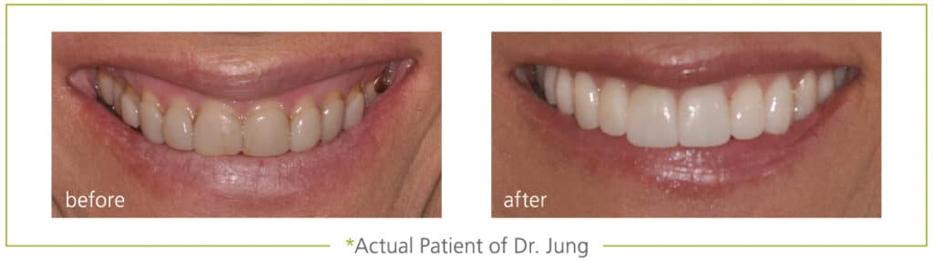 before and after pictures of dental treatments