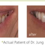 before and after pictures of dental treatments