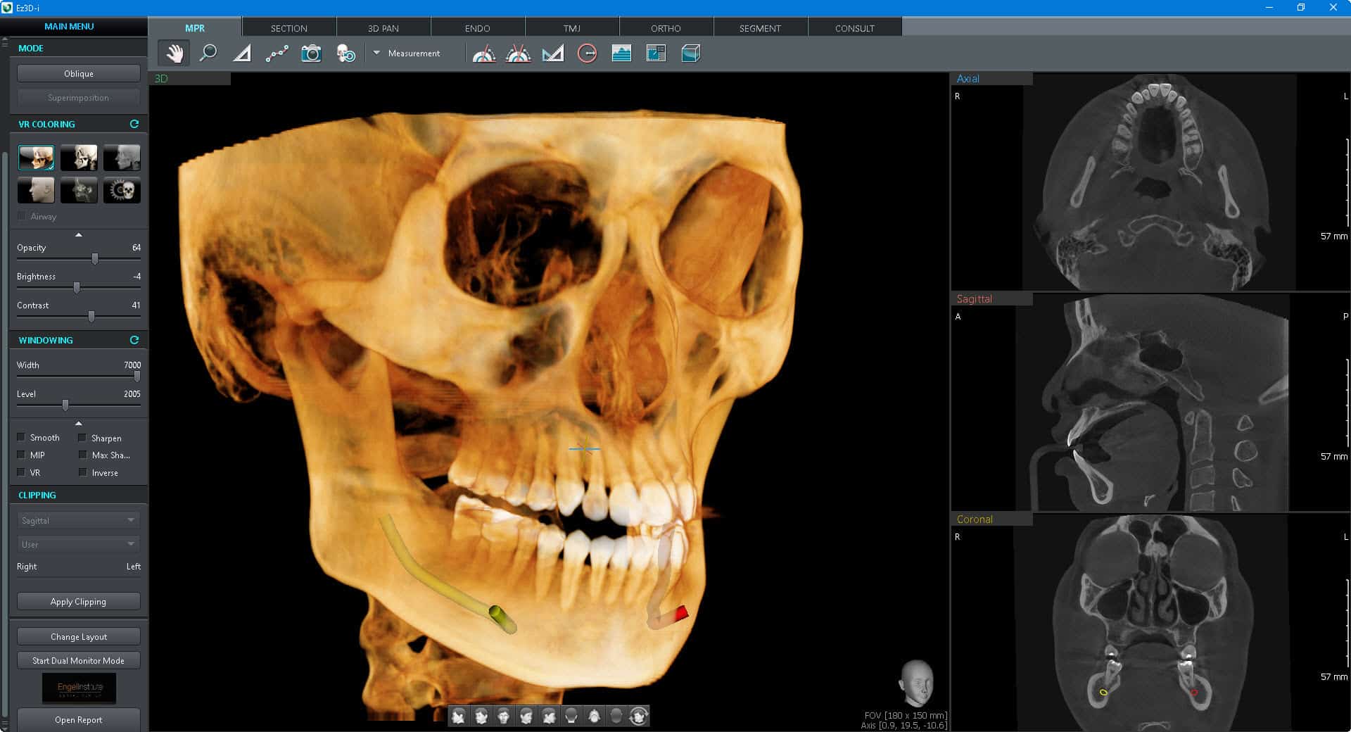 CBCT imaging