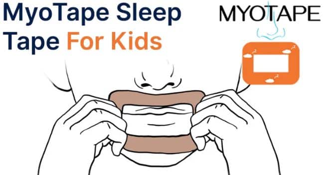 Myotape